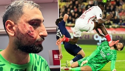 Gianluigi Donnarumma hat es schlimm erwischt. (Bild: AFP/Valery HACHE, x.com/ArthurPerrot)