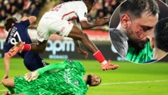 Gianluigi Donnarumma erlitt eine Schnittverletzung. (Bild: AFP/Valery HACHE)