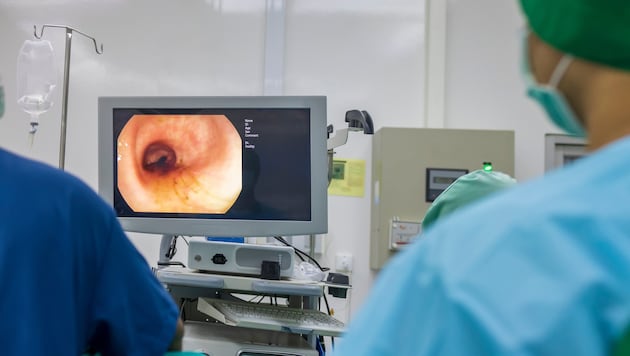 In the case of intestinal complaints, the health insurance companies cover the costs of the colonoscopy - regardless of age. (Bild: stock.adobe.com/Issara)