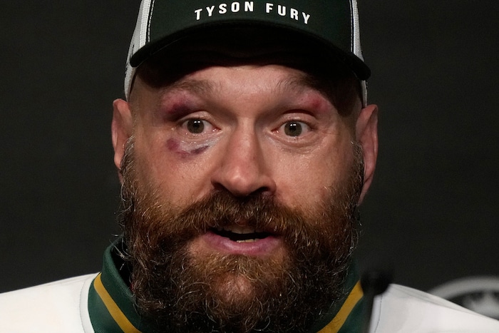 Tyson Fury nach dem Kampf