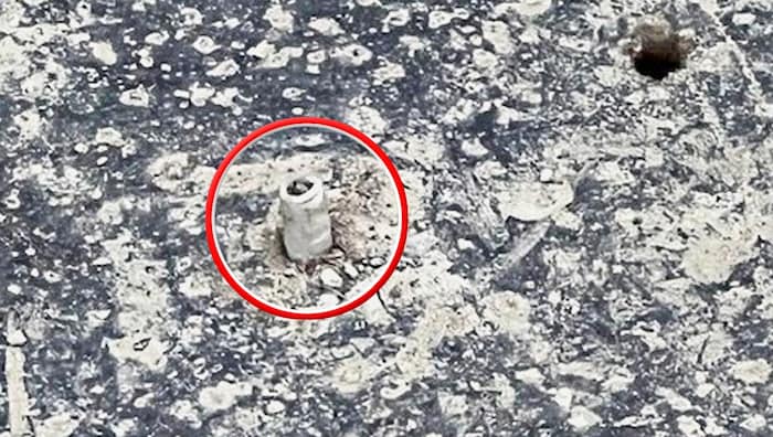 The 86-year-old stumbled over this dowel. The construction company forgot to remove it after ...