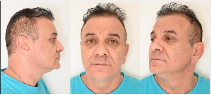 Murat K. (47 years old)