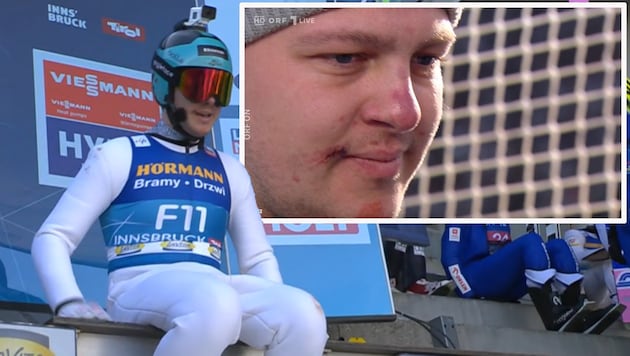 Maximilian Lienher fell down the Bergisel ski jump on Saturday with minor abrasions to his face. (Bild: Screenshot orf.at)