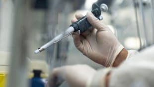 Forscherinnen und Forscher der Universität Bern haben herausgefunden, dass das Mpox-Virus ...