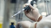 Forscherinnen und Forscher der Universität Bern haben herausgefunden, dass das Mpox-Virus ...