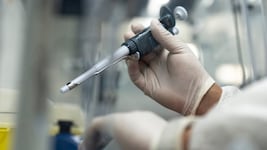 Forscherinnen und Forscher der Universität Bern haben herausgefunden, dass das Mpox-Virus ...