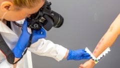 Vor der Fotowand in den Untersuchungszimmern werden Fotos als Beweise gemacht. 