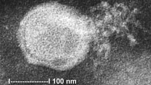 Elektronenmikroskopische Aufnahme des humanen Metapneumovirus (Bild: CDC)