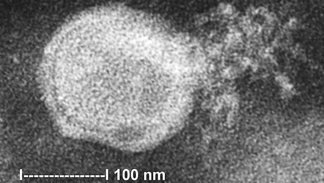 Elektronenmikroskopische Aufnahme des humanen Metapneumovirus (Bild: CDC)