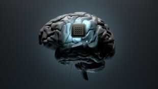 Was geschieht, wenn Neuroimplantate keine Updates mehr erhalten? (Bild: stock.adobe.com/RareStock)