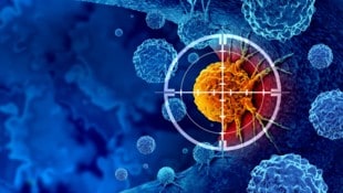 Der Tumor steht im Fokus der körpereigenen Immunabwehr. (Bild: stock.adobe.com/freshidea - stock.adobe.com)