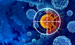 Der Tumor steht im Fokus der körpereigenen Immunabwehr.