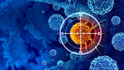 Der Tumor steht im Fokus der körpereigenen Immunabwehr.