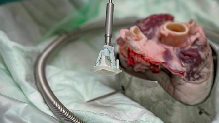 Die 3D-gedruckte Klappenprothese wird in das Schweineherz verpflanzt.