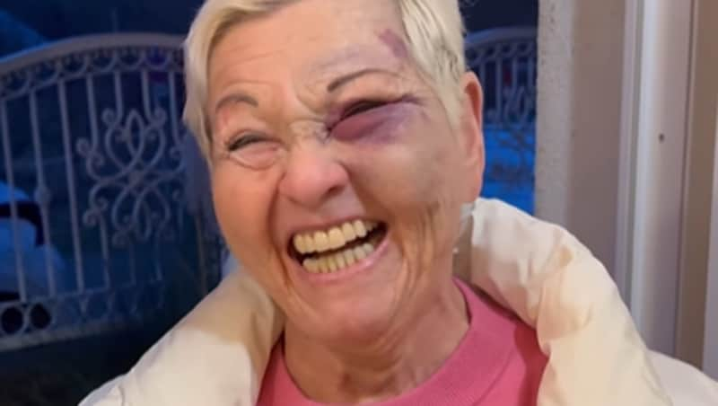 She can laugh about it again! (Bild: instagram.com/jazzgitti_official)