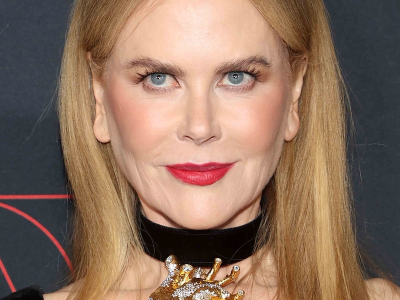 Im Fachjargon nennt sich das Phänomen, das auch an Kidman gut zu sehen ist, „Elfenohren“-Deformation. (Bild: Photo Press Service)