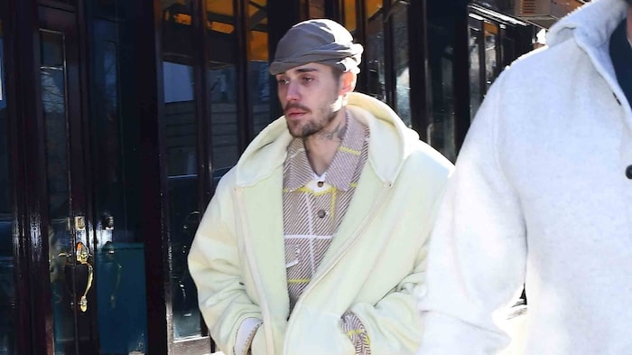 Was ist bloß mit Justin Bieber los? Der Sänger schaut derzeit ziemlich fertig aus.