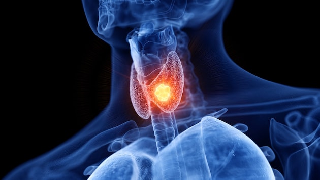 Die Macht der Schilddrüse wird oft unterschätzt.