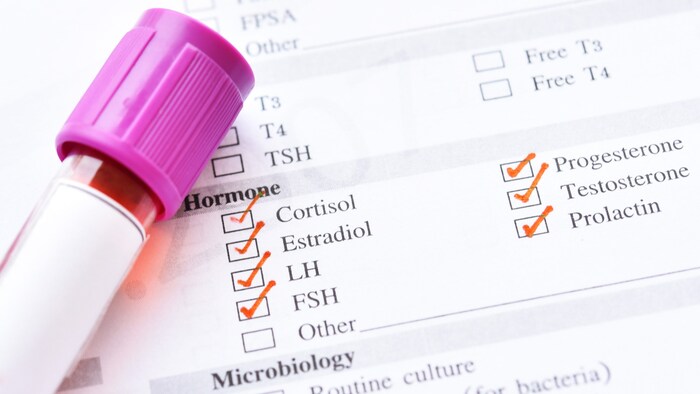 Hormone sind ein wichtiges Teilgebiet der Endokrinologie. 