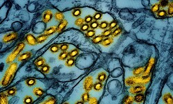 Kolorierte elektronenmikroskopische Aufnahme, die Partikel des Vogelgrippevirus A H5N1 (gelb) in ...