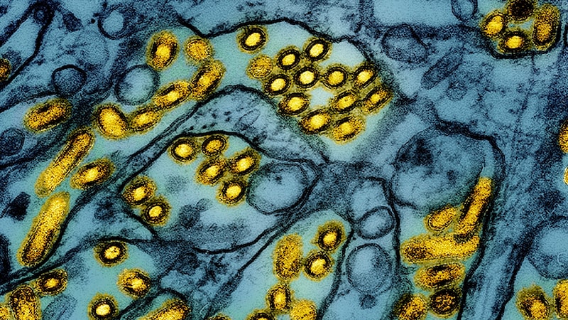 Colored electron micrograph showing particles of the avian influenza virus A H5N1 (yellow) in epithelial cells (blue) (Bild: AP/CDC/NIAID)