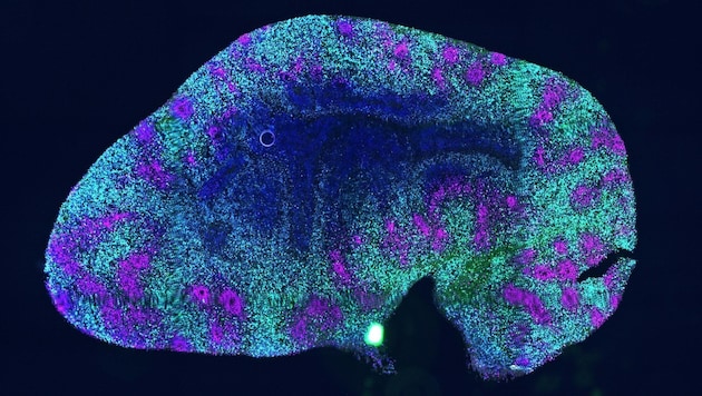 Querschnitt eines 90 Tage alten „Mini-Gehirns“ aus Stammzellen, der zeigt, dass solche Organoide altern können. (Bild: Gabassi/Edenhofer)