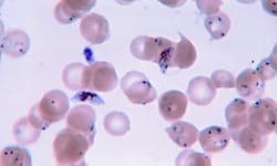 Mikroskopische Aufnahme des Einzellers Plasmodium falciparum, der für die Erkrankung an Malaria ...