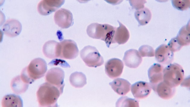 Mikroskopische Aufnahme des Einzellers Plasmodium falciparum, der für die Erkrankung an Malaria verantwortlich ist.  (Bild: CDC/Dr. Greene; Steven Glenn, Laboratory & Consultation Division)