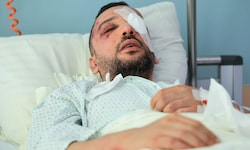 Der Iraker erlitt unter anderem am Kopf, im Gesicht und an den Augen schwere Verletzungen.