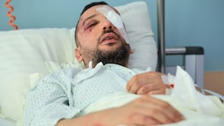 Der Iraker erlitt unter anderem am Kopf, im Gesicht und an den Augen schwere Verletzungen.