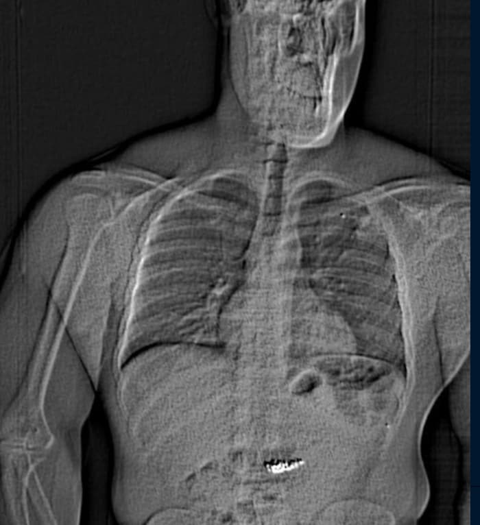Die Beamten führten einen Körperscan bei dem Festgenommenen durch.