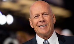 Die Sprachstörung Aphasie beendete die Schauspielkarriere von Bruce Willis.