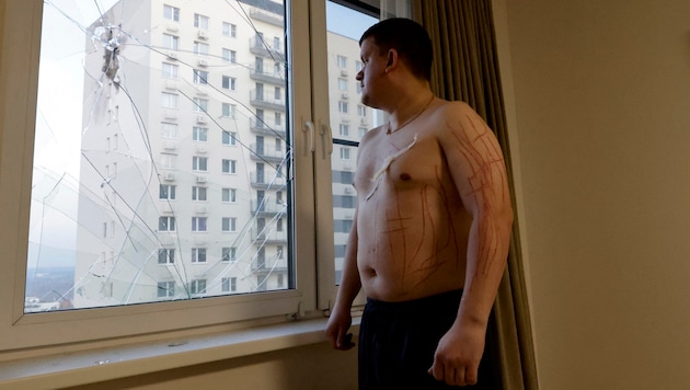 Vladislav suffered cuts from window splinters. (Bild: APA/AFP/TATYANA MAKEYEVA)