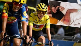 Katarzyna Niewiadoma zeigt die Folgen ihres Sturzes. 