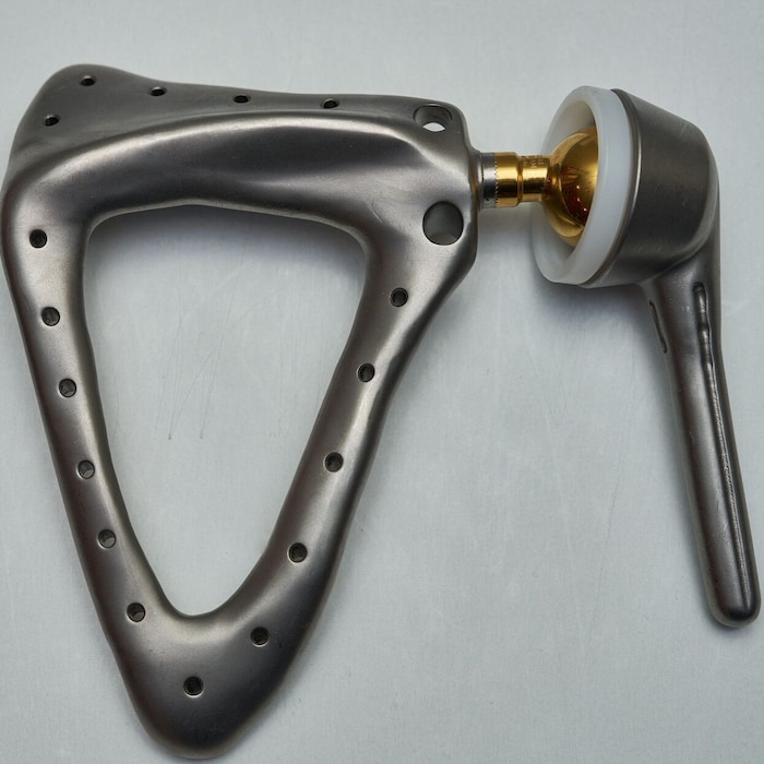 Durch diese „Schulter“ kann Gwladys bald wieder ihren Arm leicht belasten.