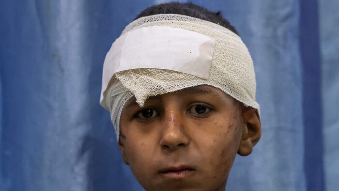 Ein verletzter Bub im Gazastreifen