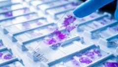 Ein entscheidender Vorteil der synthetischen Herstellung des Moleküls ist, dass es so ideal für ...