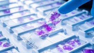 Ein entscheidender Vorteil der synthetischen Herstellung des Moleküls ist, dass es so ideal für ...