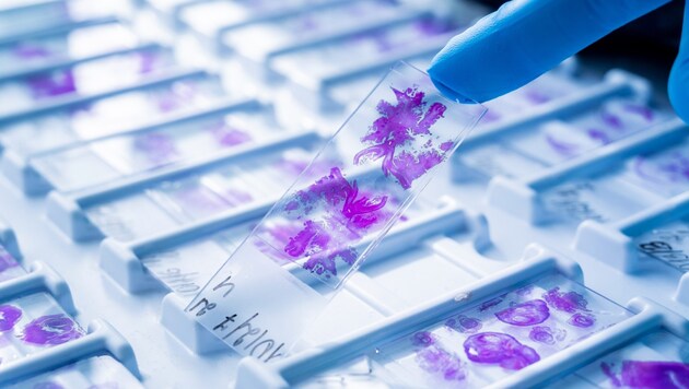 Ein entscheidender Vorteil der synthetischen Herstellung des Moleküls ist, dass es so ideal für ...