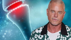 Hollywood-Star Eric Dane (53) starb an der Nervenkrankheit ALS.