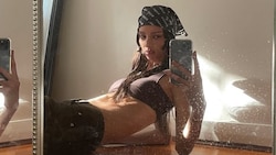 Das Model ist 27-jährig an einer seltenen Gefäßerkrankung gestorben.