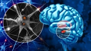 Bei Parkinson führt der fortschreitende Verlust Dopamin-produzierender Nervenzellen im Gehirn zu Symptomen wie Zittern. (Bild: stock.adobe.com null)