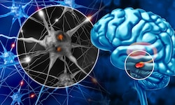 Bei Parkinson führt der fortschreitende Verlust Dopamin-produzierender Nervenzellen im Gehirn zu ...