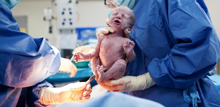 Die meisten Kinder in Österreich kommen im Spital zur Welt. Die Hausgeburtenrate liegt hierzulande bei 1,8 Prozent, in den Niederlanden bei rund 30 Prozent.