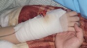 Sophie ist stark. Die 12-Jährige hat schon mehr als 100 chirurgische Eingriffe hinter sich. ...