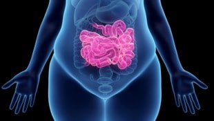 Wer zu bestimmten Lebensmitteln greift, schafft ideale Voraussetzungen für ein stabiles Mikrobiom und Gewichtsverlust. (Bild: stock.adobe.com null)