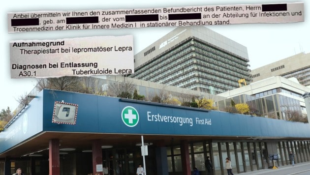 Lepromatöse Lepra, die schwerste Form der Krankheit, war laut Befund der Auslöser für die Behandlung. Der Patient wird im AKH Wien betreut. Die Ansteckung könnte auf einer der vielen Reisen in Afrika oder den Tropen passiert sein. (Bild: Krone KREATIV/Jöchl Martin)