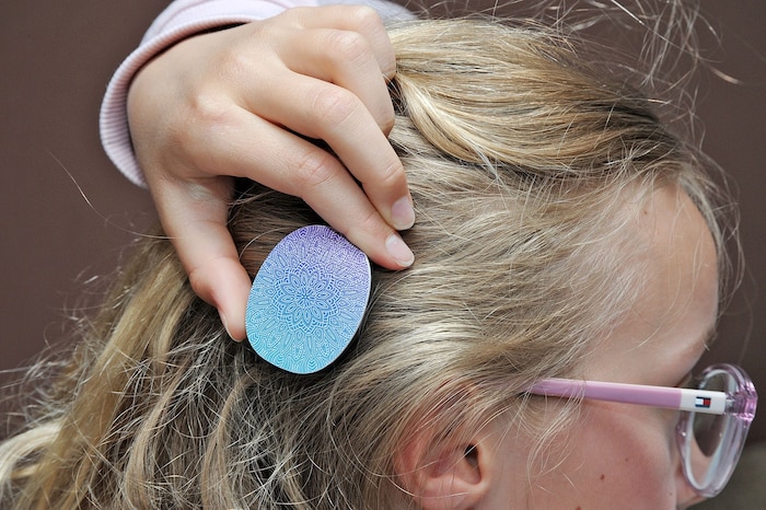 Der äußere Teil des Cochlea-Implantats