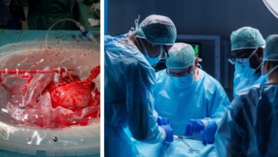 Von der Entnahme bis zum Einsetzen eines Organs hatten die Mediziner bisher oft sehr wenig Zeit. Ein neues Gerät (Bild li.) schafft neue Möglichkeiten.  (Bild: tirol kliniken/stock.adobe.com null/Krone KREATIV)