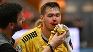 Das Horror-Foul an Bregenz-Handballer Markus Mahr (Bild), der sich einen offenen Nasenbeinbruch zuzog, hat weitreichende Konsequenzen. (Bild: GEPA)